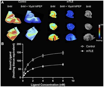 Reduced Metabotropic Glutamate Receptor Type 5 Availability in the Epileptogenic Hippocampus: An in vitro Study